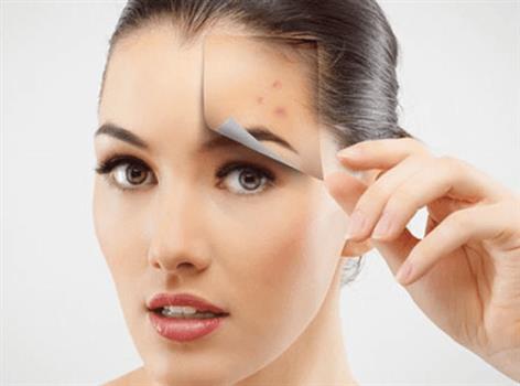  LÀM SAO ĐỂ THOÁT KHỎI MỤN TRỨNG CÁ DAI DẲNG ?