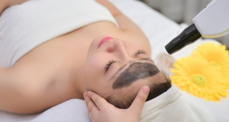 Laser than hoạt tính trẻ hóa da