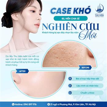 CASE KHÓ - BS. HIỀN CHIA SẺ NGHIÊN CỨU MỚI
