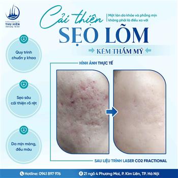CẢI THIỆN S.ẸO LÕM KÉM THẨM MỸ