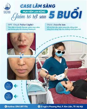 CASE LÂM SÀNG | #MỤN_VIÊM LAN RỘNG – GIẢM RÕ RỆT SAU #5_BUỔI XỬ LÝ CHUẨN Y KHOA