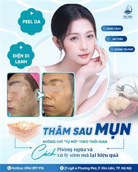 #THÂM_SAU_MỤN KHÔNG CHỈ “TỰ MỜ” THEO THỜI GIAN