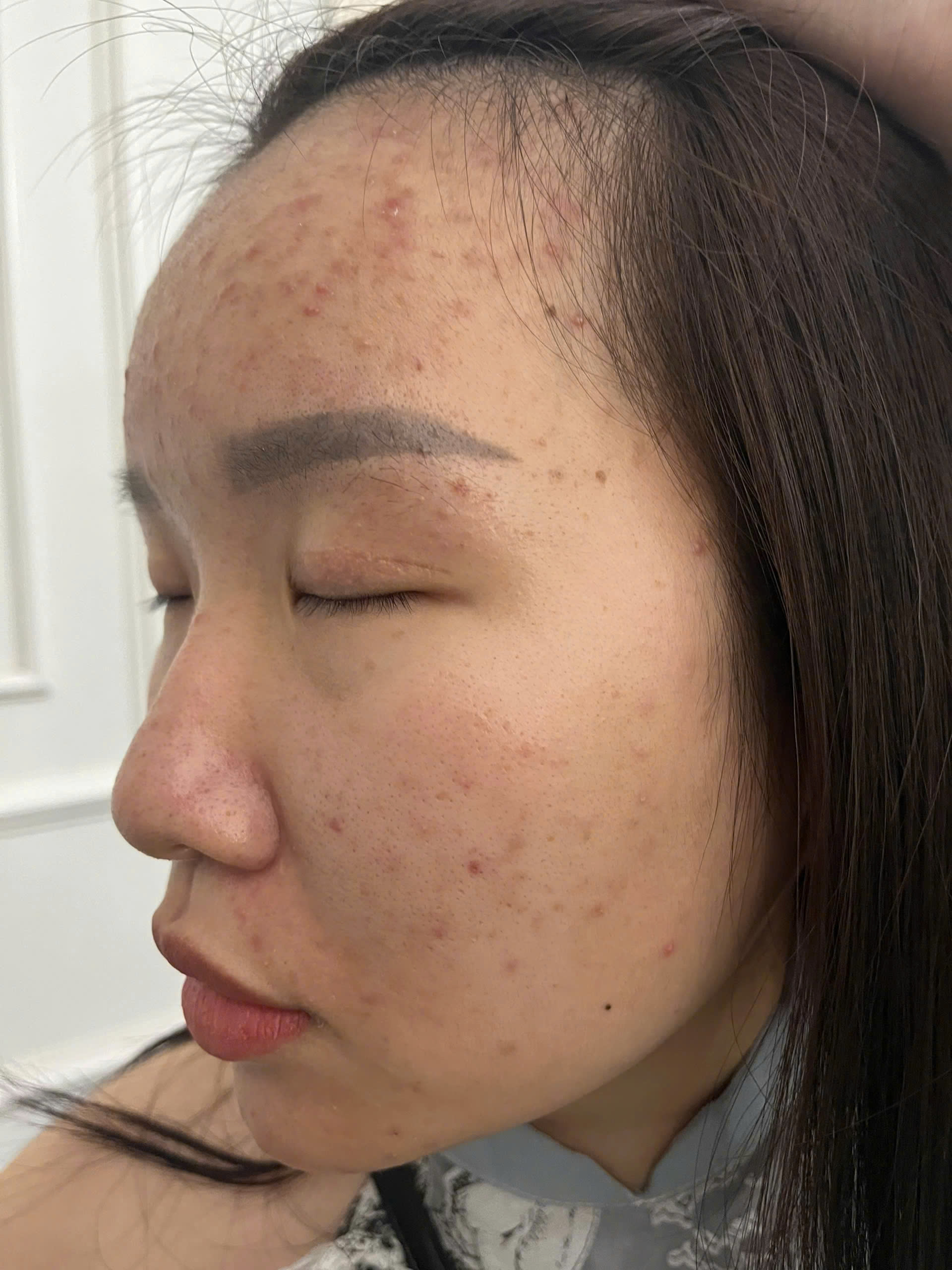 Before image