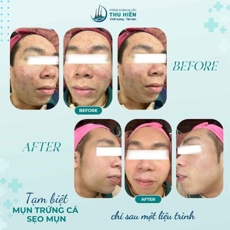 Làm thật – hiệu quả thật