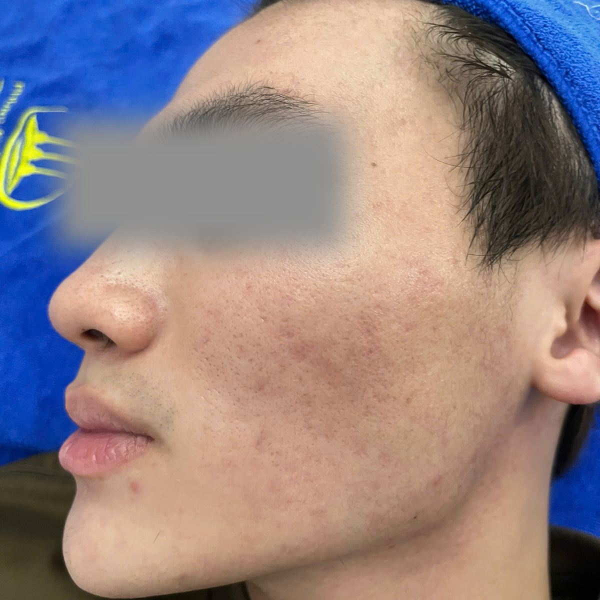 Before image