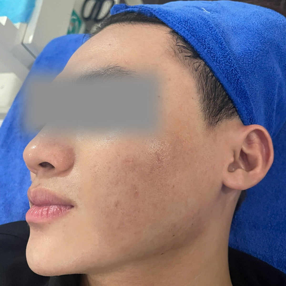 After image