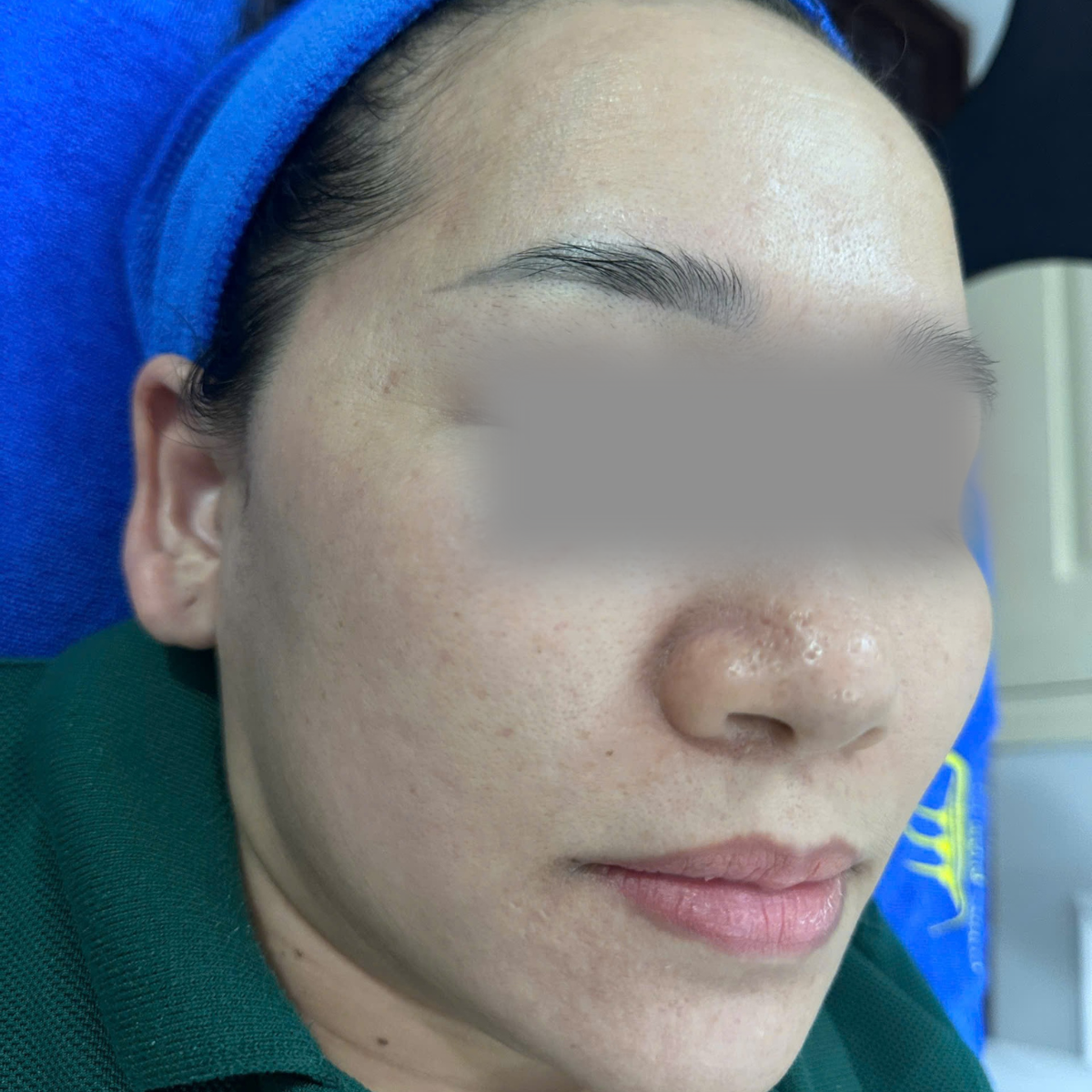 After image