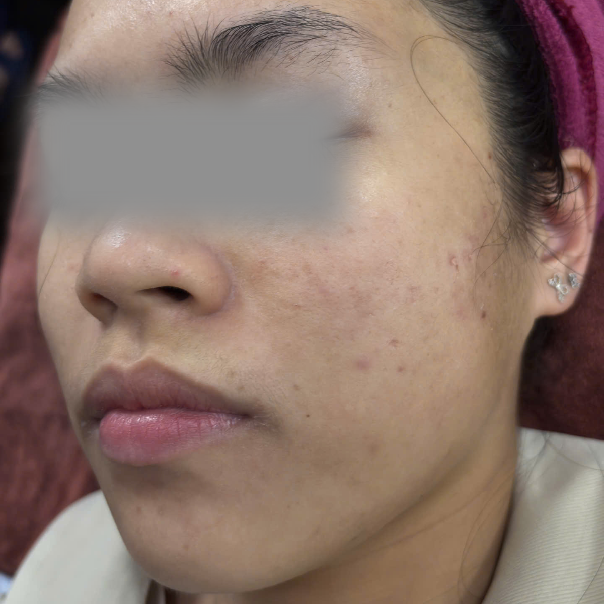 Before image