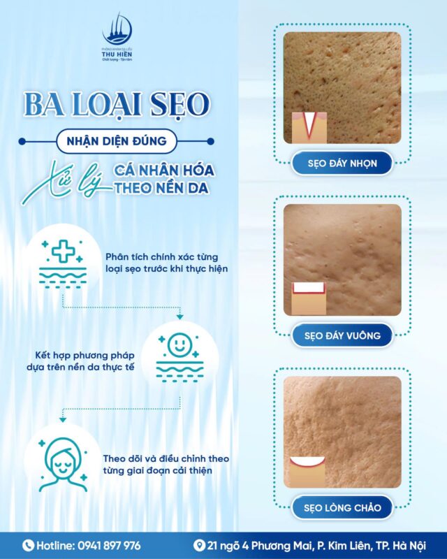 BA LOẠI SẸO – NHẬN DIỆN ĐÚNG ĐỂ KHÔNG “TỐN TIỀN OAN”