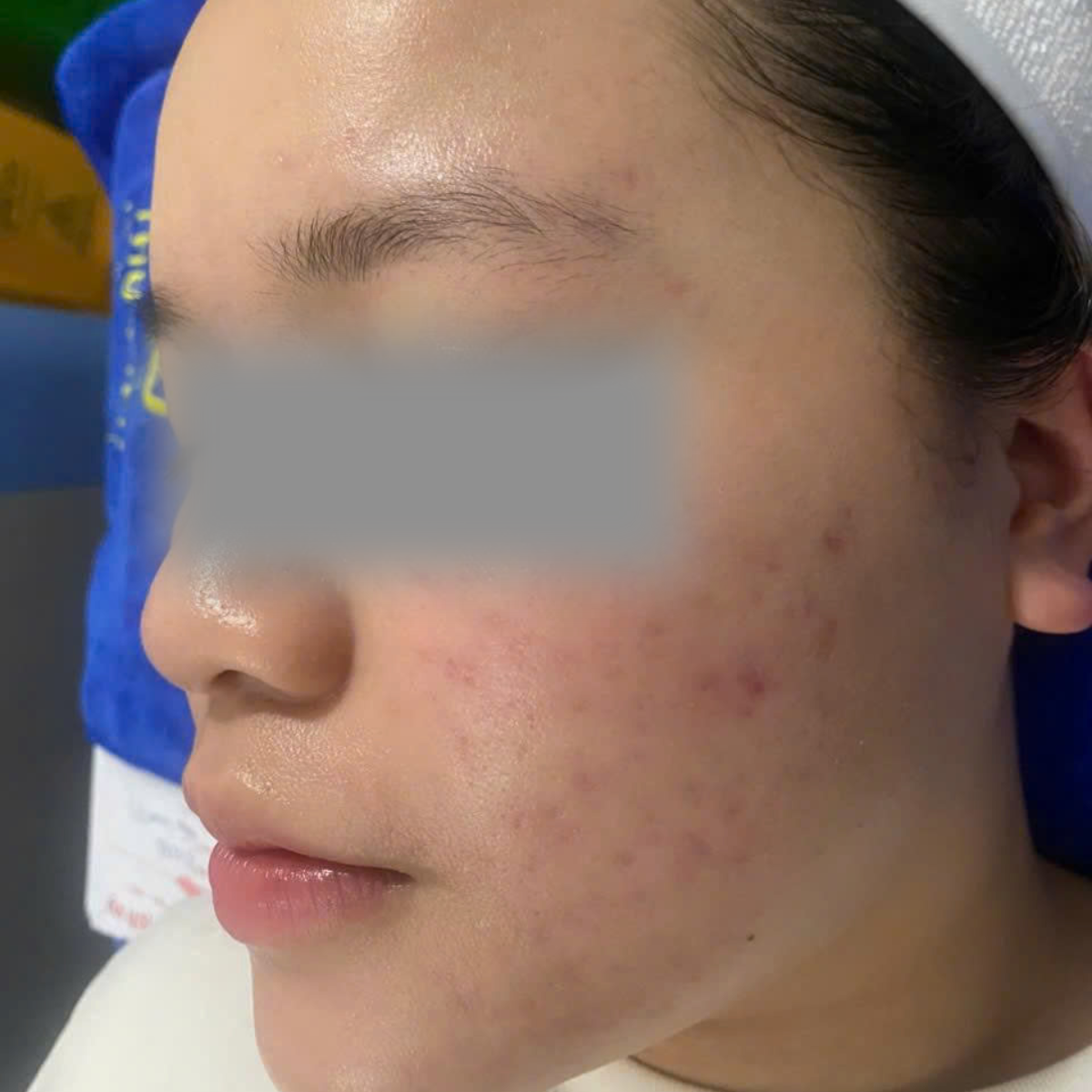 After image