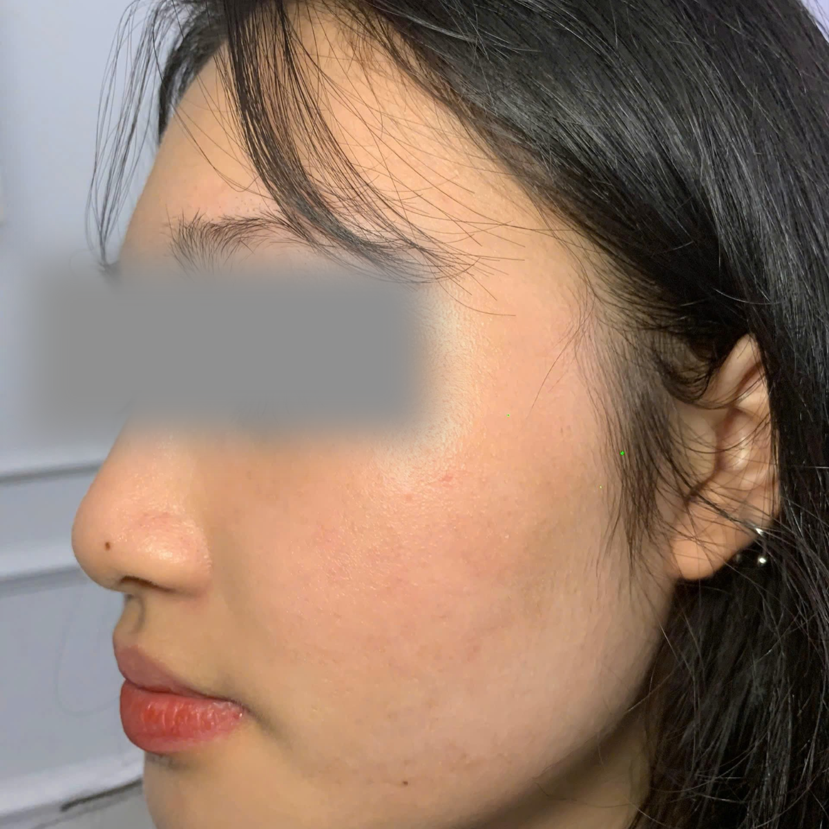 After image