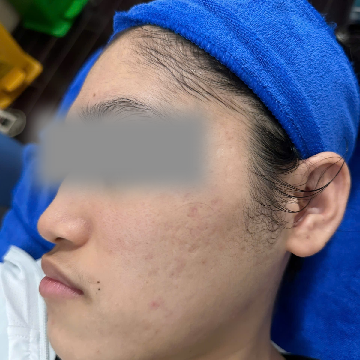 After image