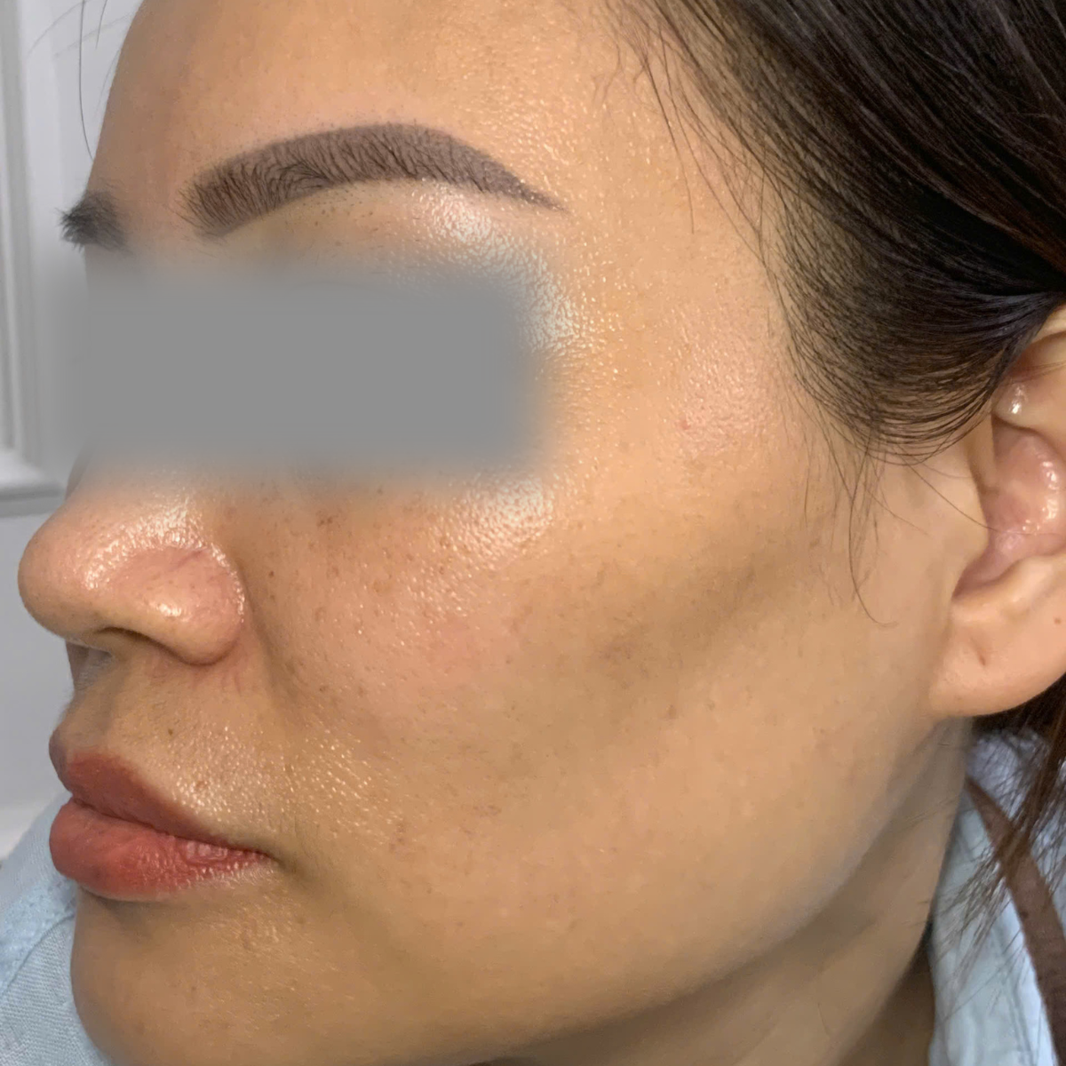 Before image