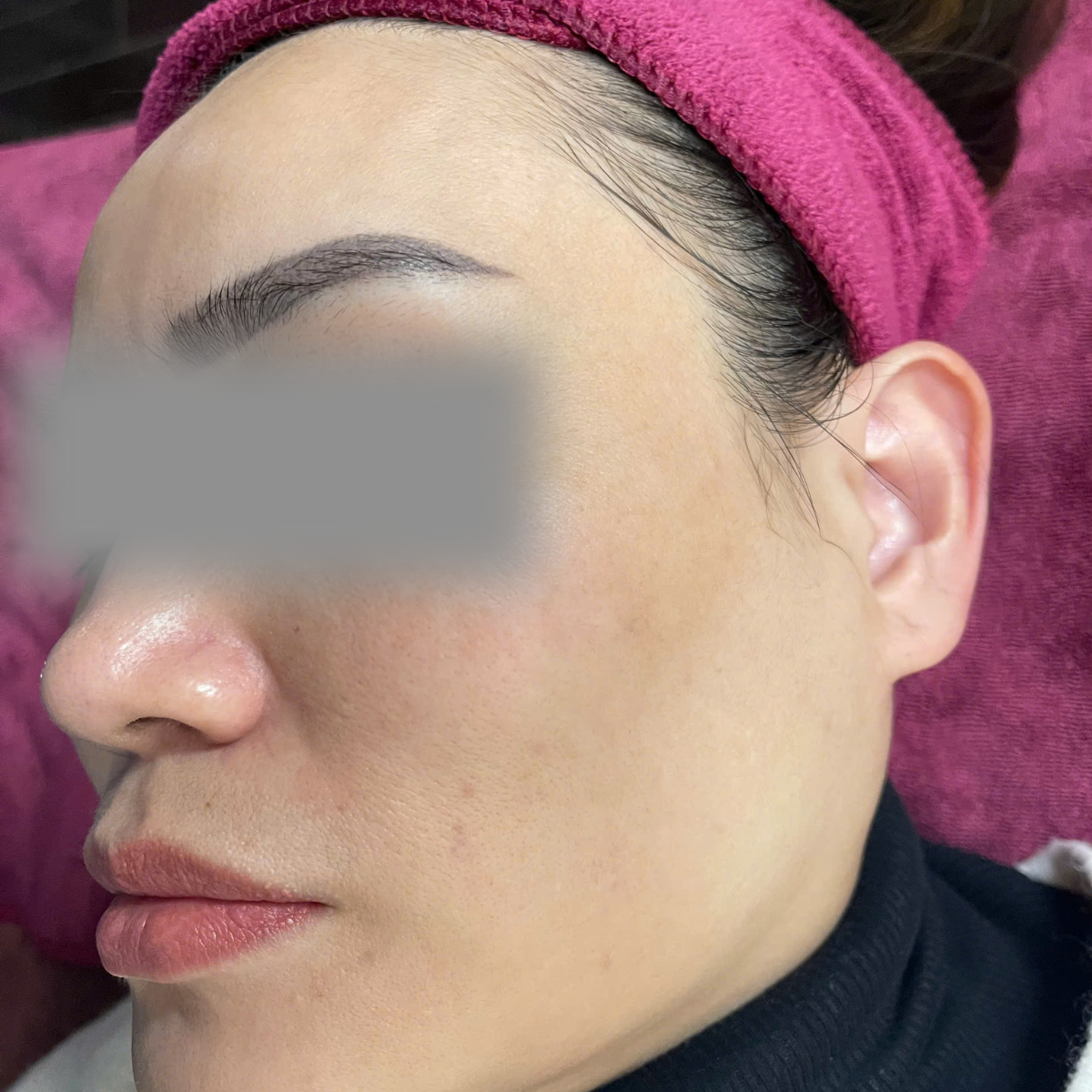 After image
