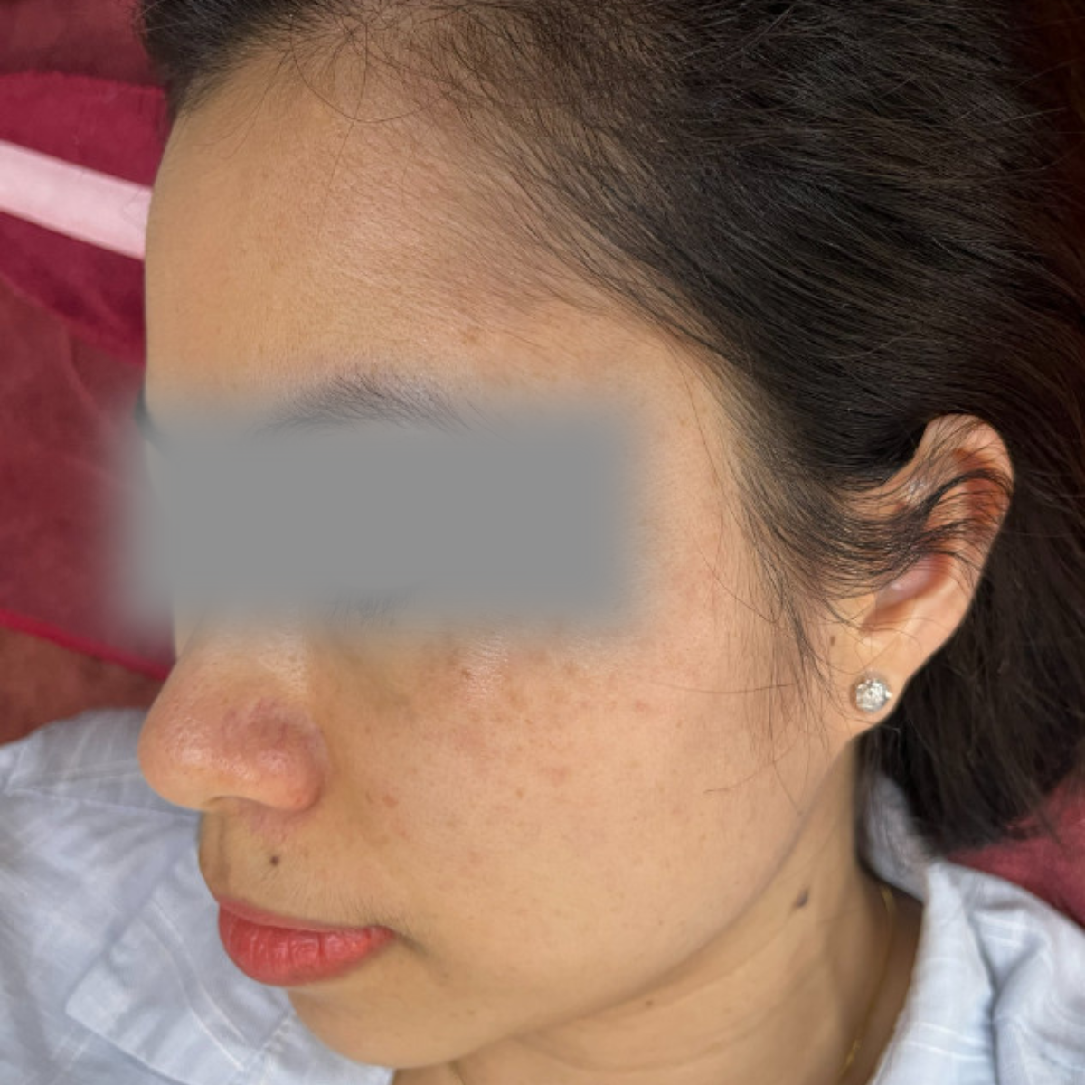 Before image