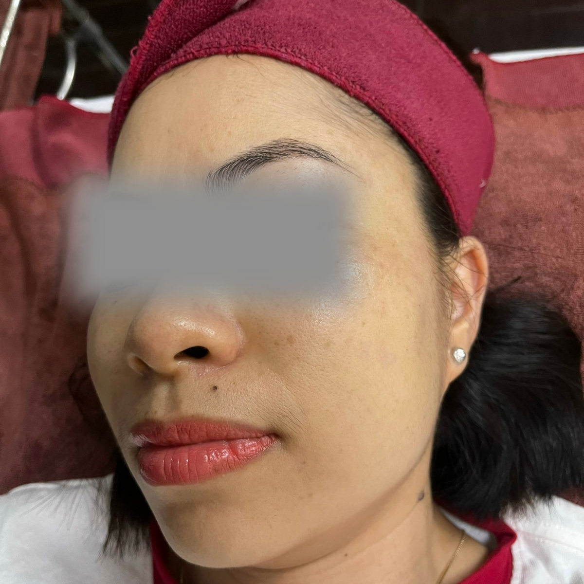 After image