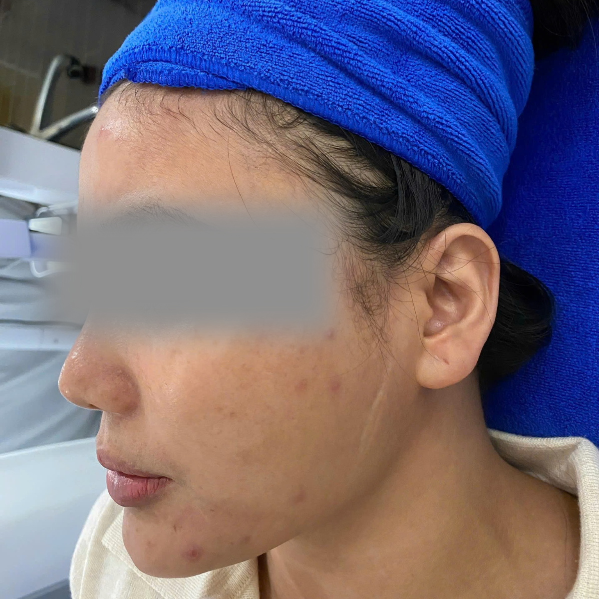Before image