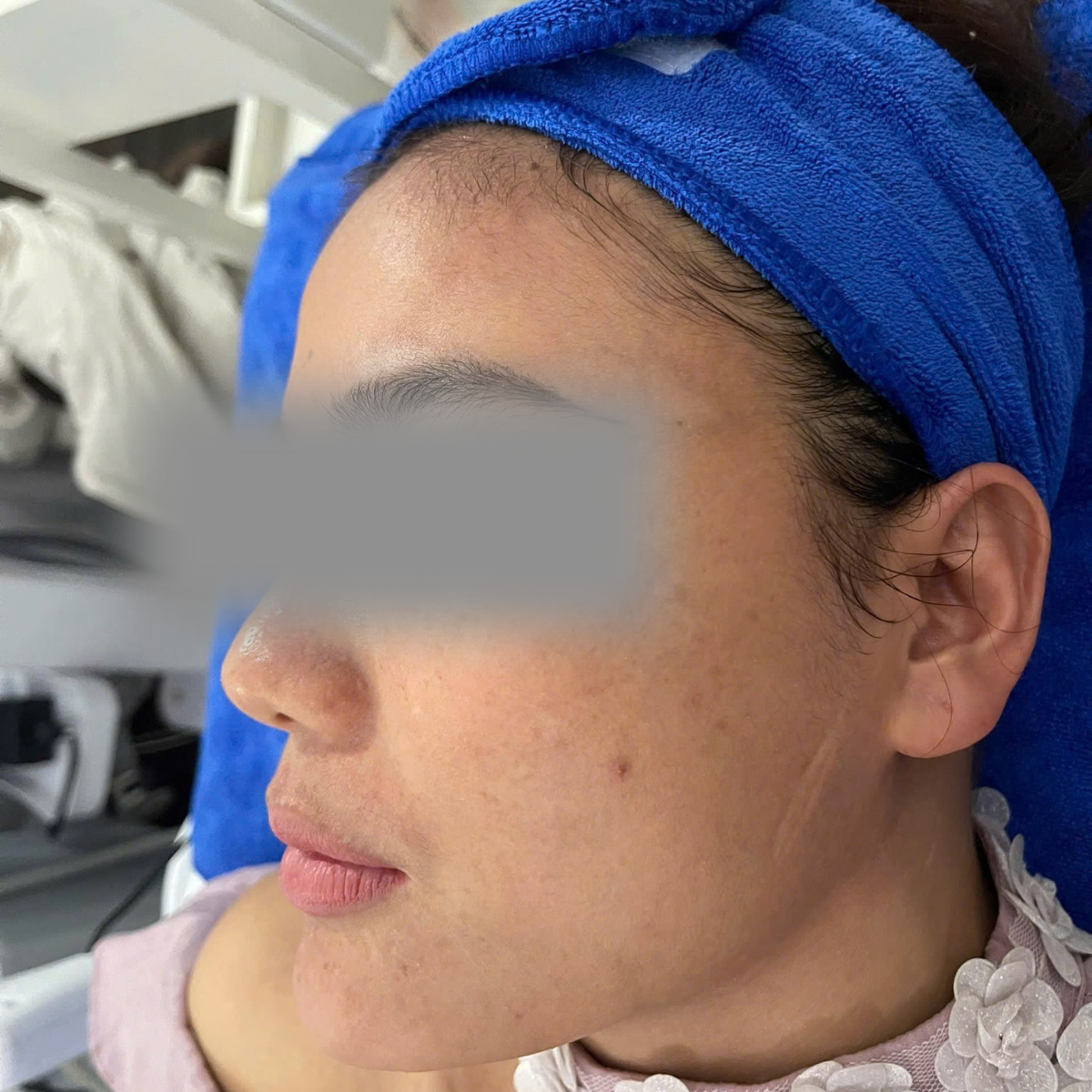 After image