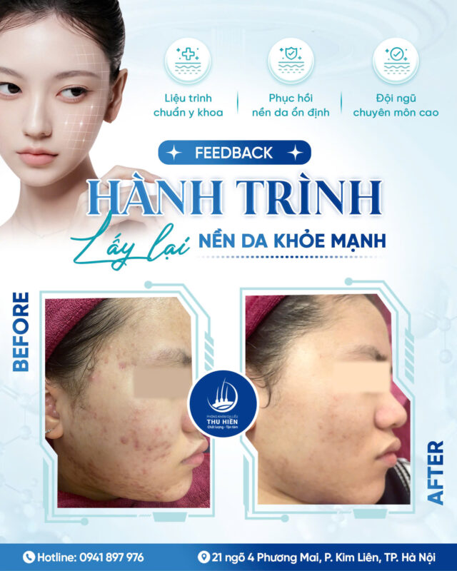 [FEEDBACK] 𝑀𝑈̣𝑁 𝑉𝐼𝐸̂𝑀 BÙNG PHÁT MÙA HÈ