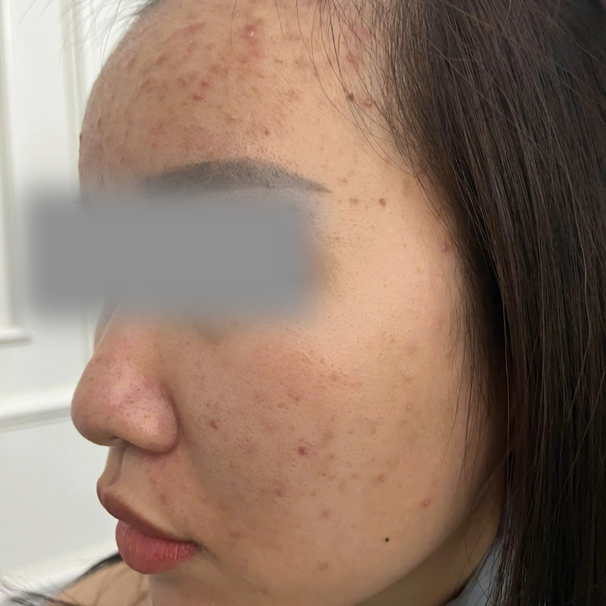 Before image