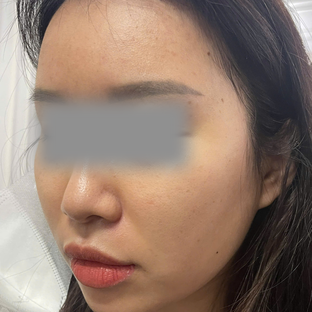 After image