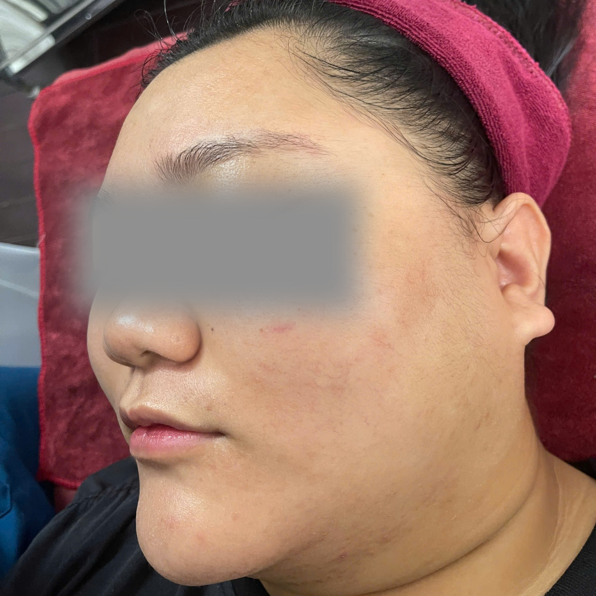 After image