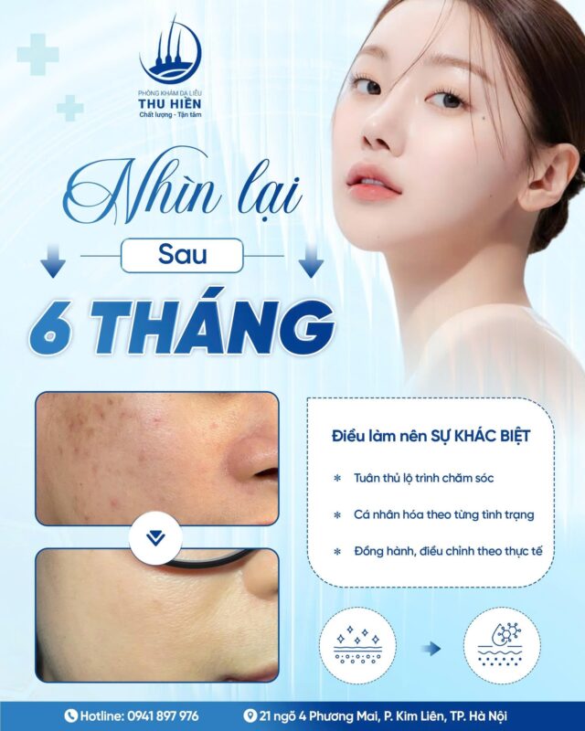 NHÌN LẠI SAU 6 THÁNG – KHI MẶT MỘC TRỞ THÀNH NIỀM TỰ TIN