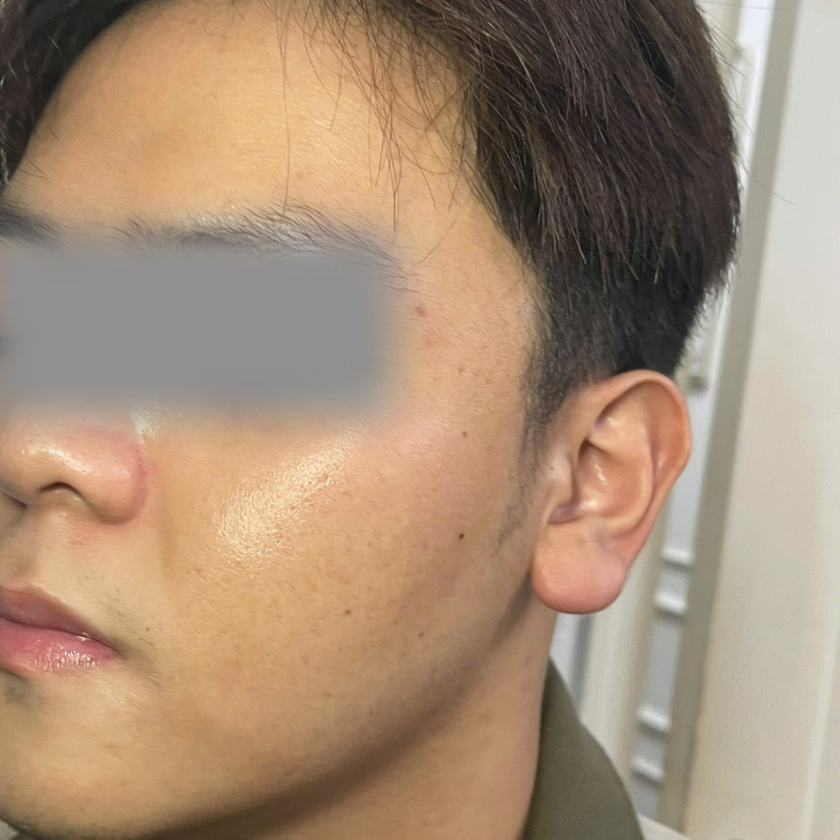 After image