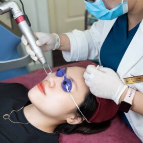 Công nghệ Laser CO2 Fractional giúp kích thích tái tạo, làm đầy hố sẹo hiệu quả