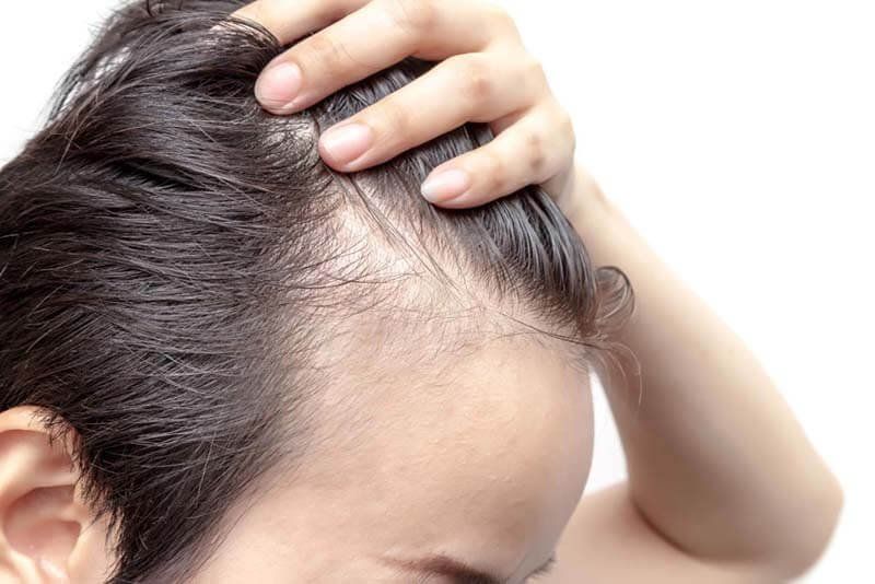 Cần thăm khám y khoa sớm để đánh giá mức độ tổn thương của nang tóc