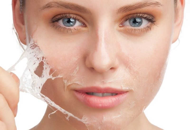 Cơ chế hoạt chất peel bóc tách lớp tế bào sừng chứa hắc tố Melanin
