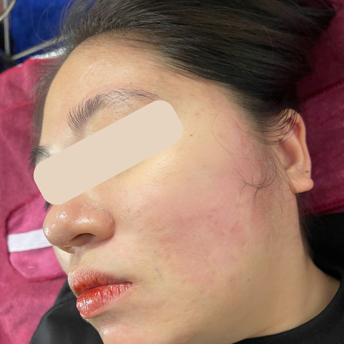 After image