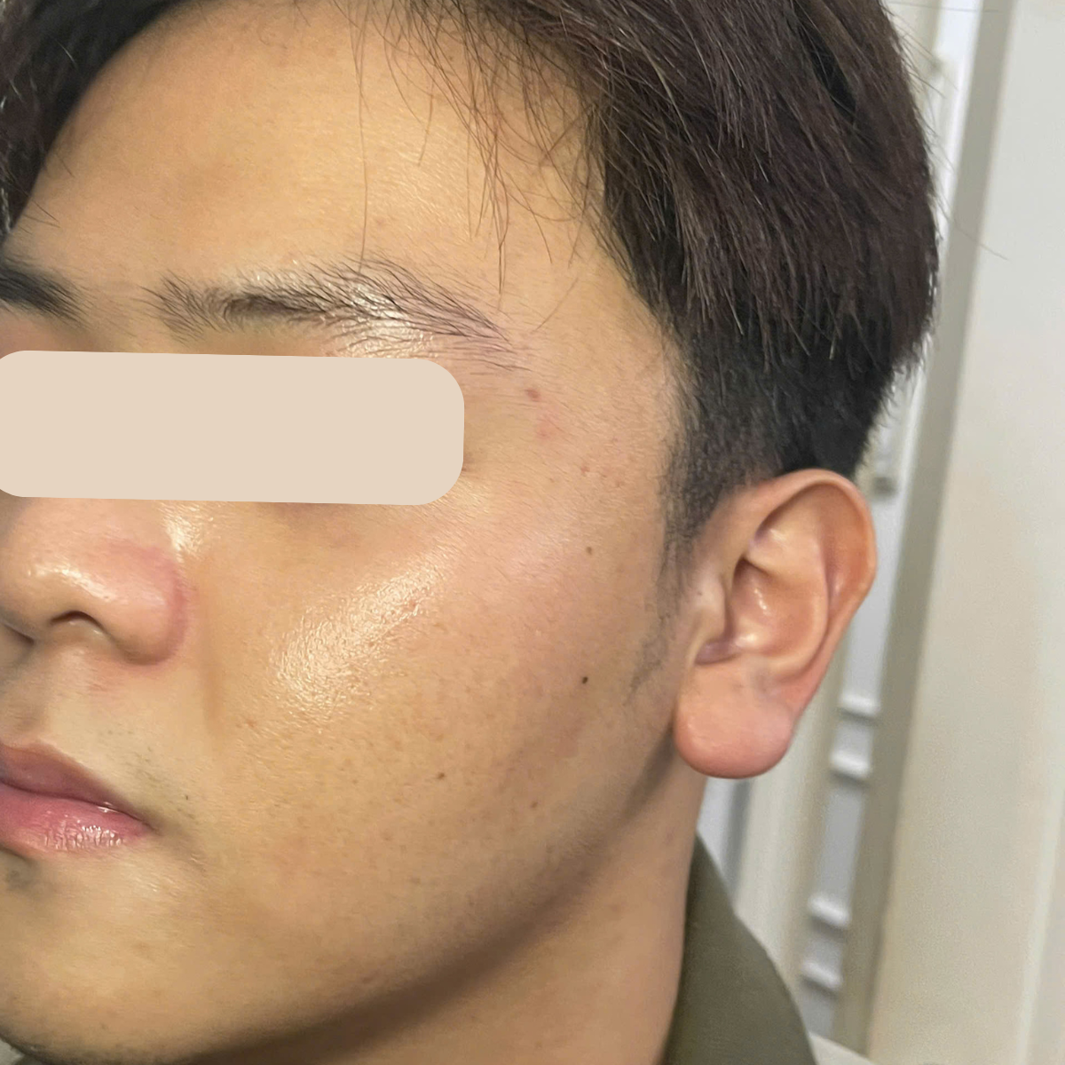 After image