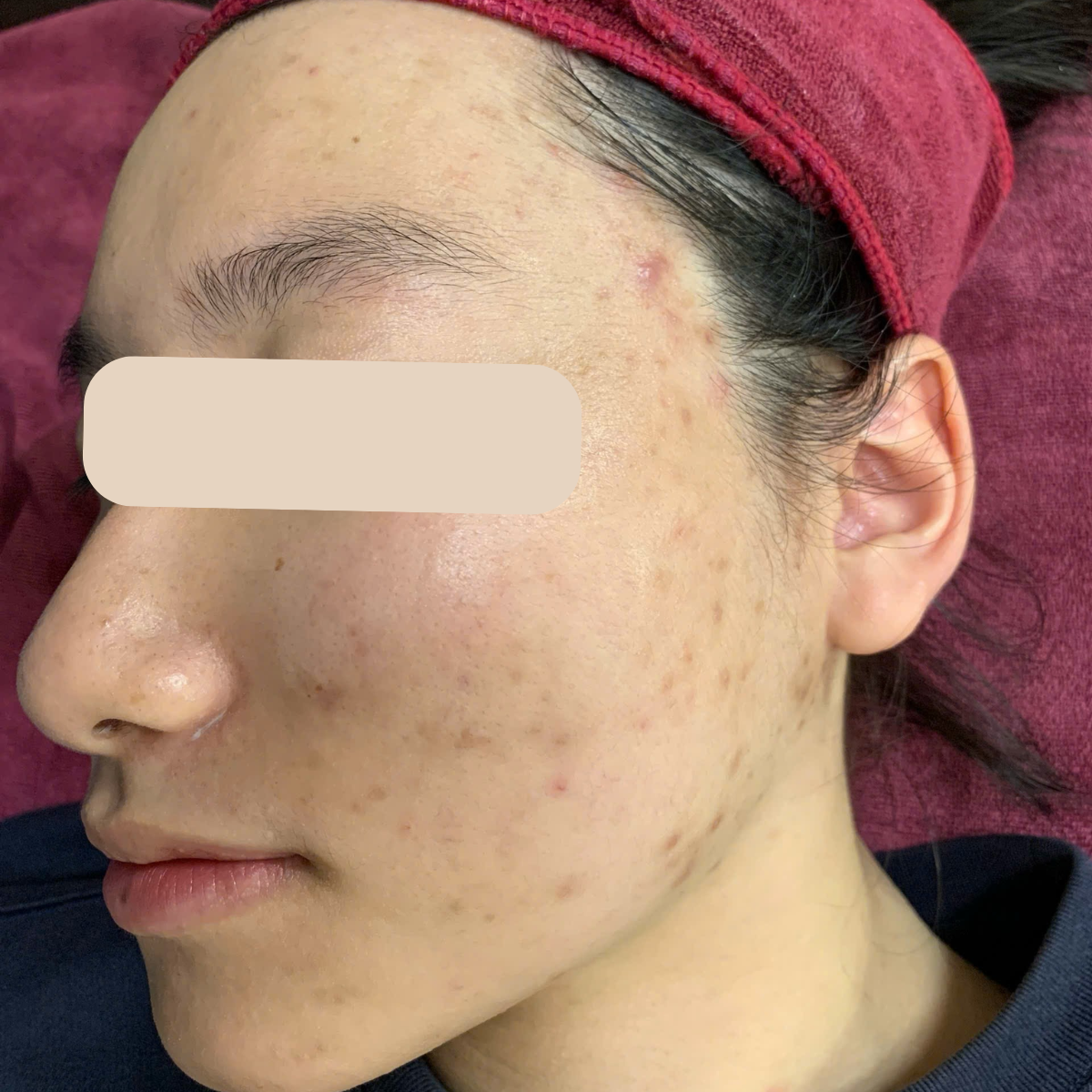 Before image