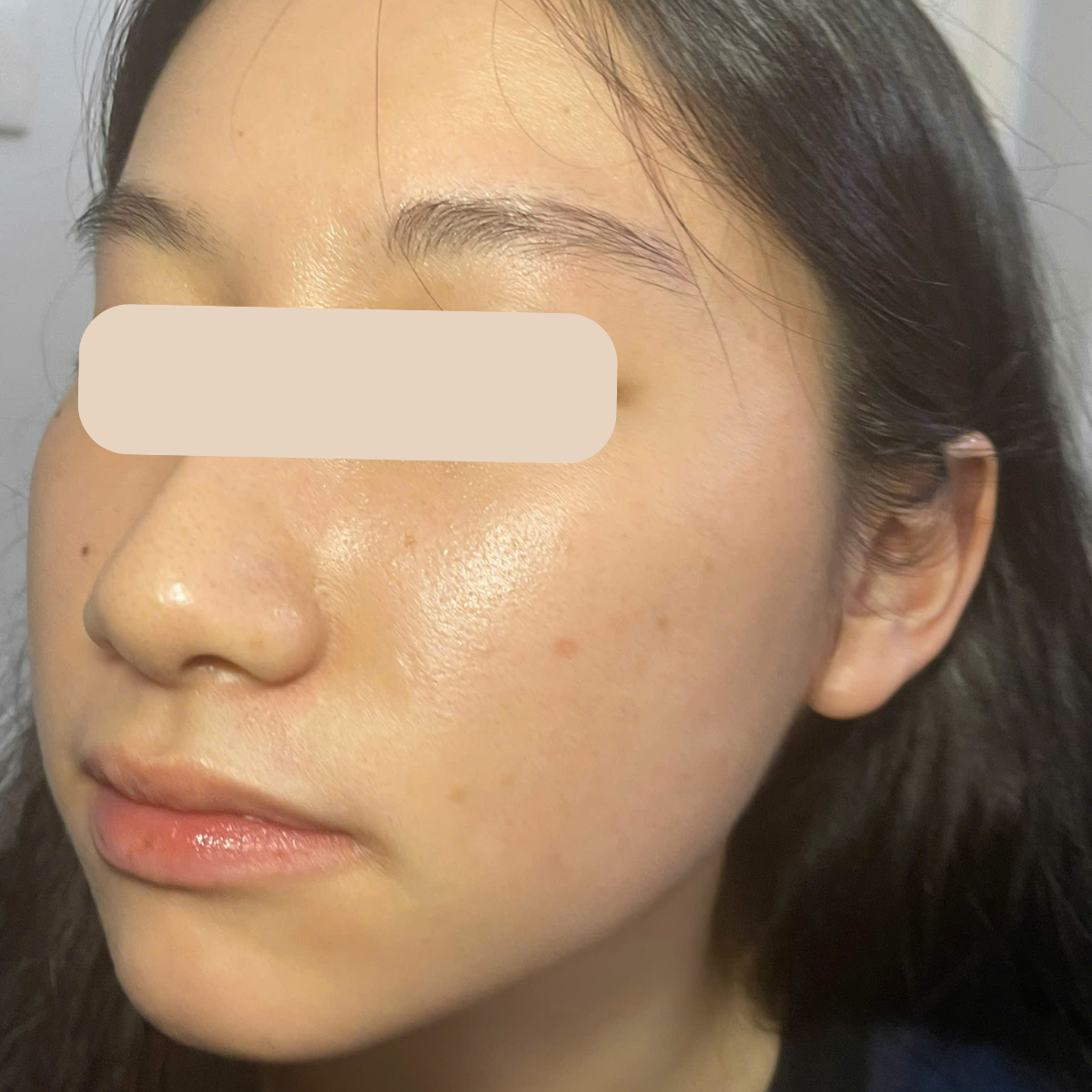 After image