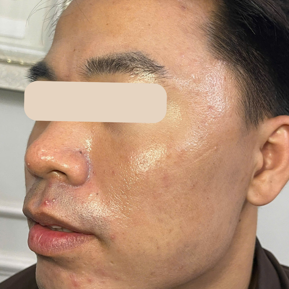 After image