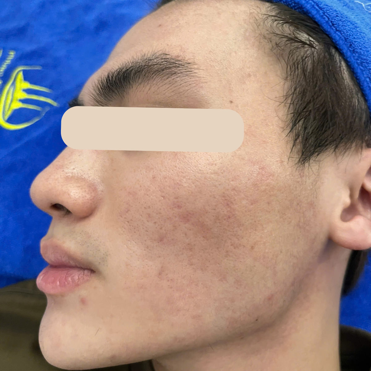 Before image