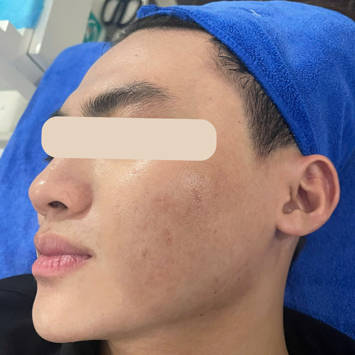 After image
