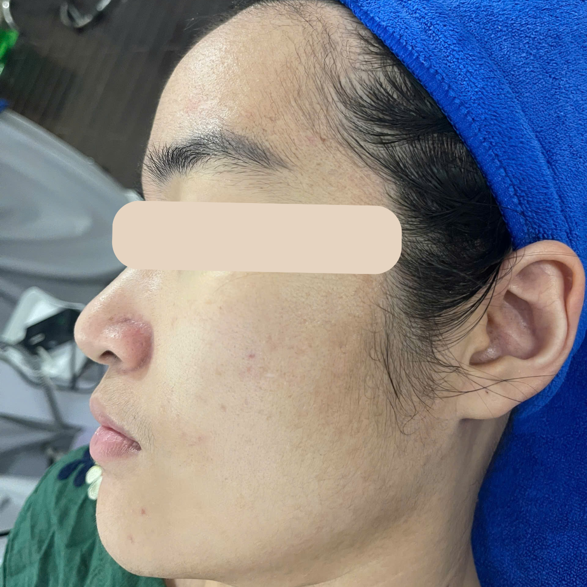 After image