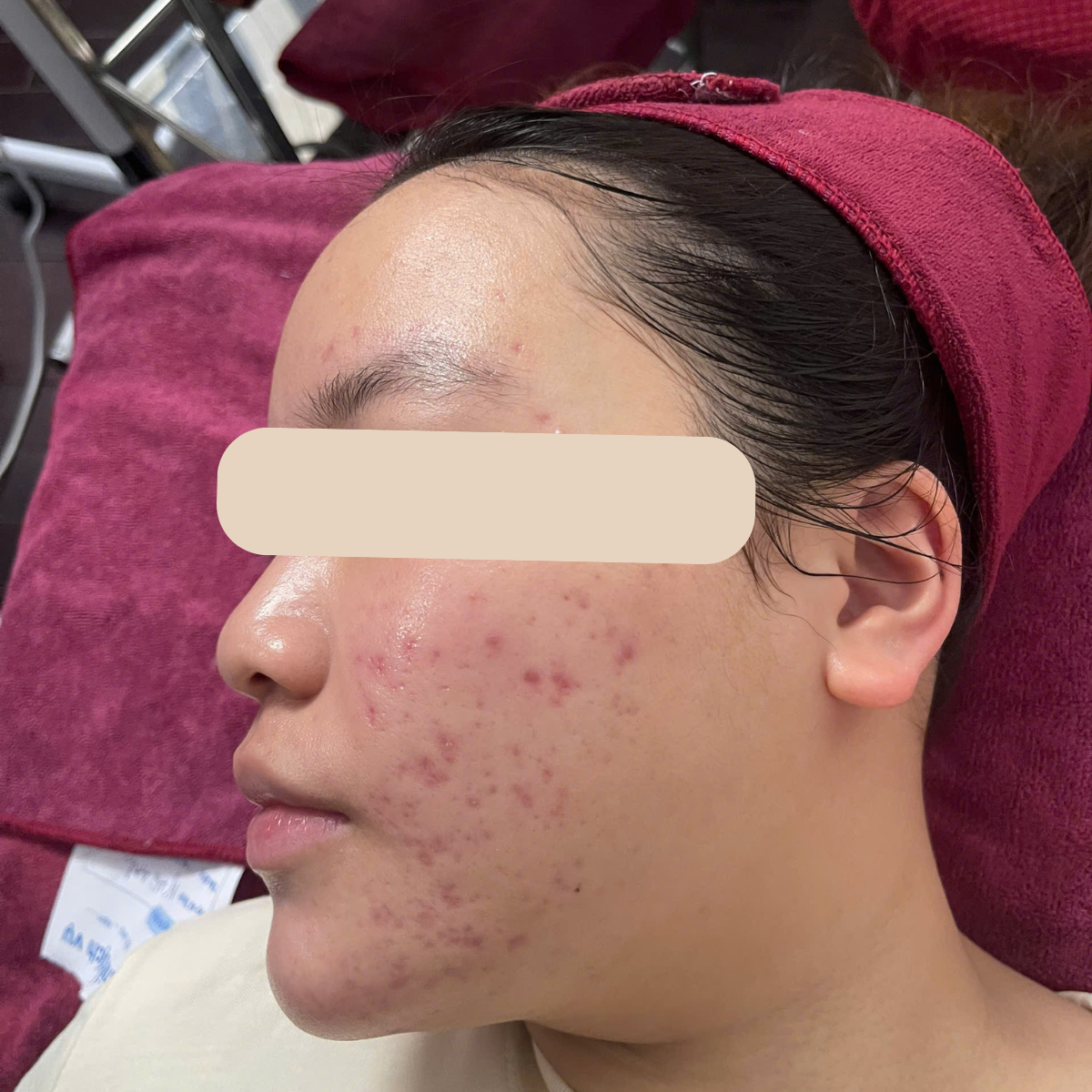 Before image