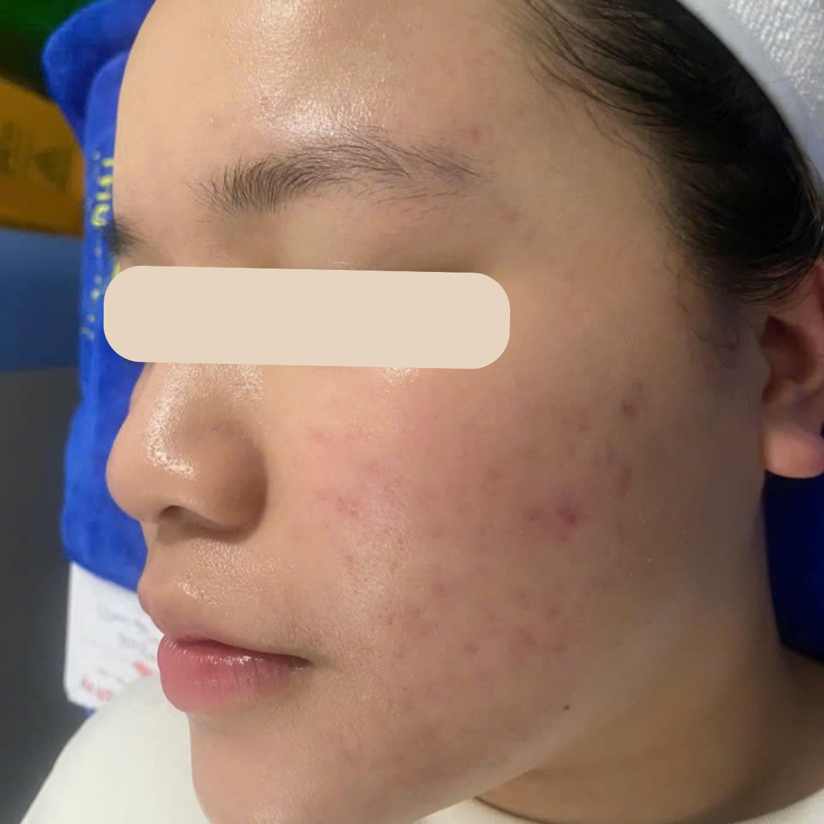 After image