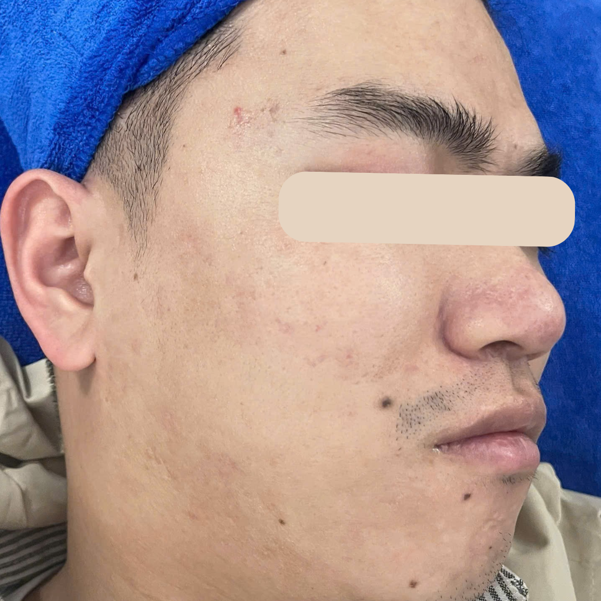 After image