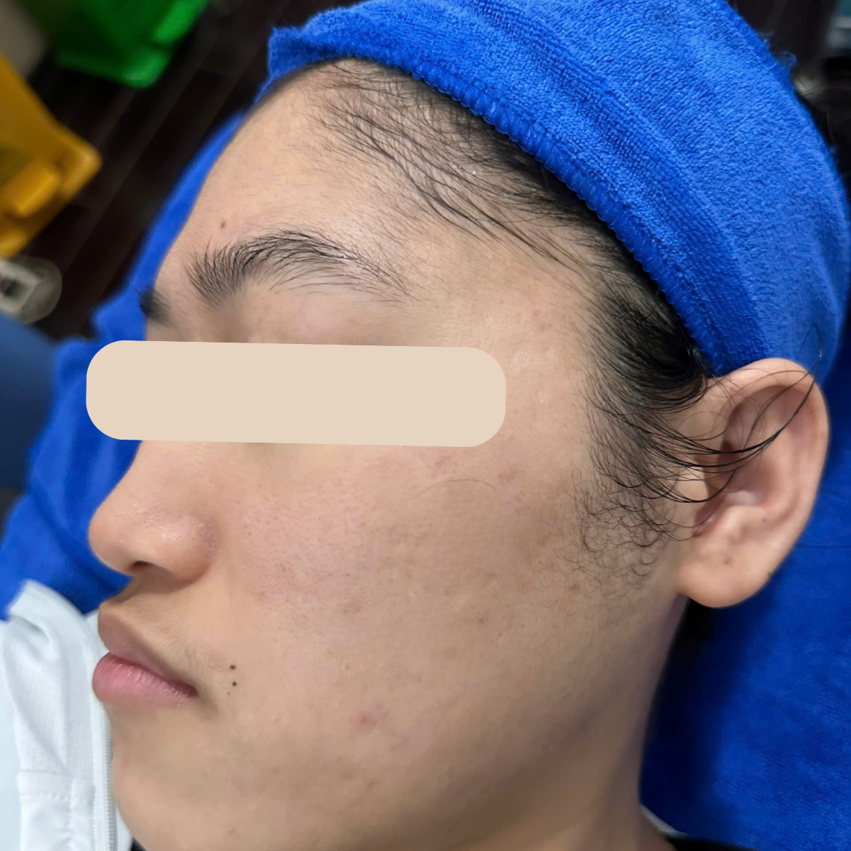 After image