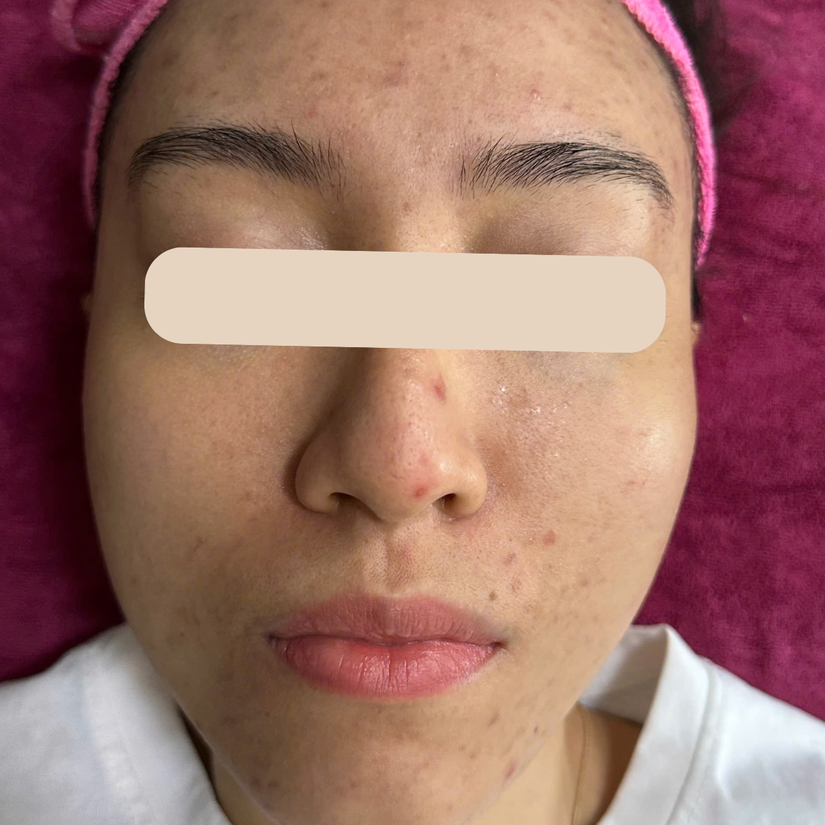 Before image