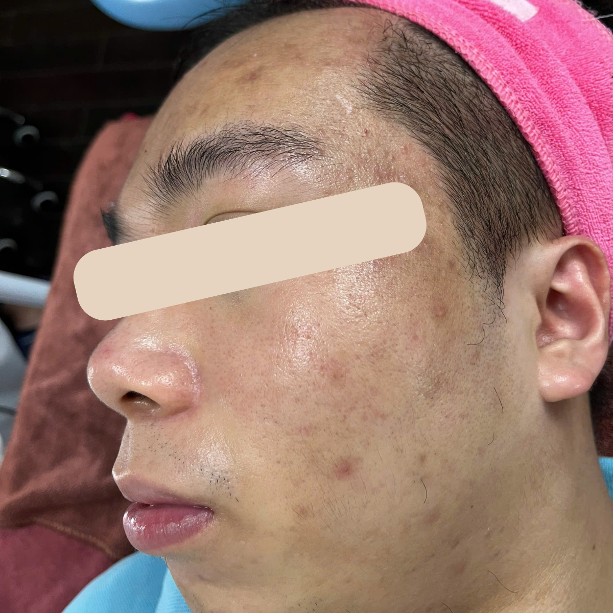 Before image