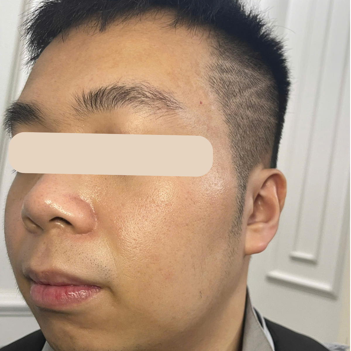 After image