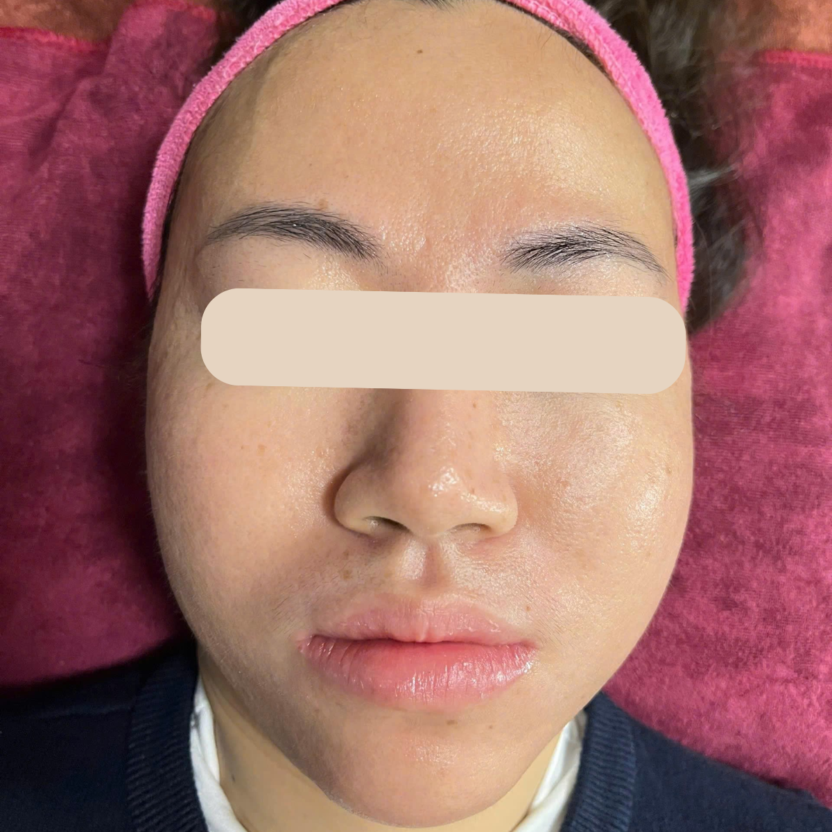 After image