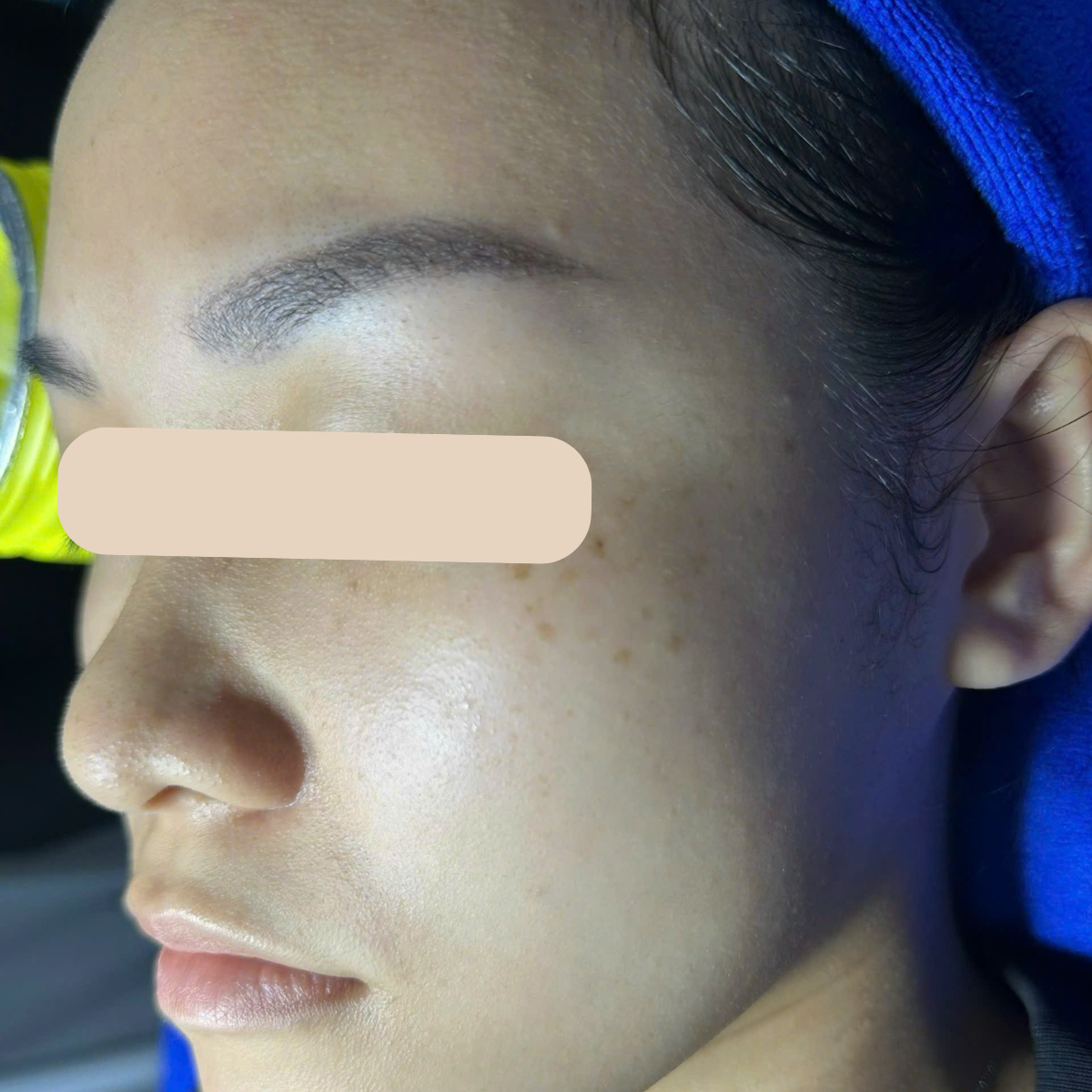 Before image