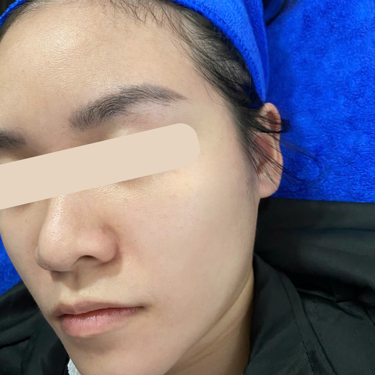 After image