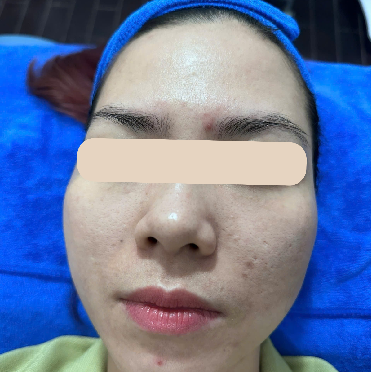 After image
